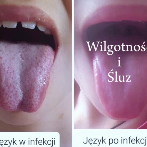 Wilgoność i śluz Webinar Wilgotność i Śluz