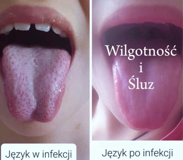 Webinar Wilgotność i Śluz